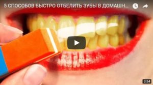 Как отбелить зубы в домашних условиях - интересное видео